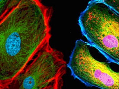 无自发荧光，成像效果佳，可用于荧光显微实验、激光共聚焦显微实验、荧光原位杂交（FISH）和相差显微实验等